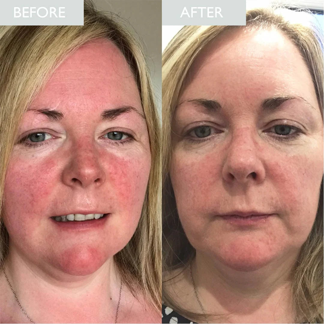 Advanced Calming Serum